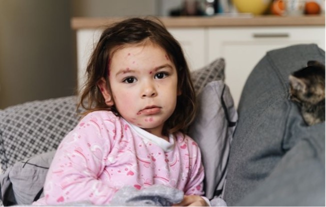 cocuk-enfeksiyon-hastaliklari